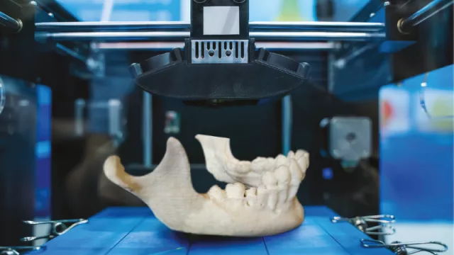 Ahora vas poder tocar tu radiografía (con impresoras 3D)