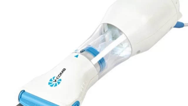 Llegaron a Argentina las aspiradoras chupa piojos (compra online a $ 2.700 y con entrega en Chaco y Corrientes)