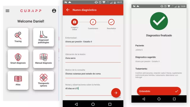CurApp, la IA también asiste a los médicos (diagnósticos dermatológicos más precisos)